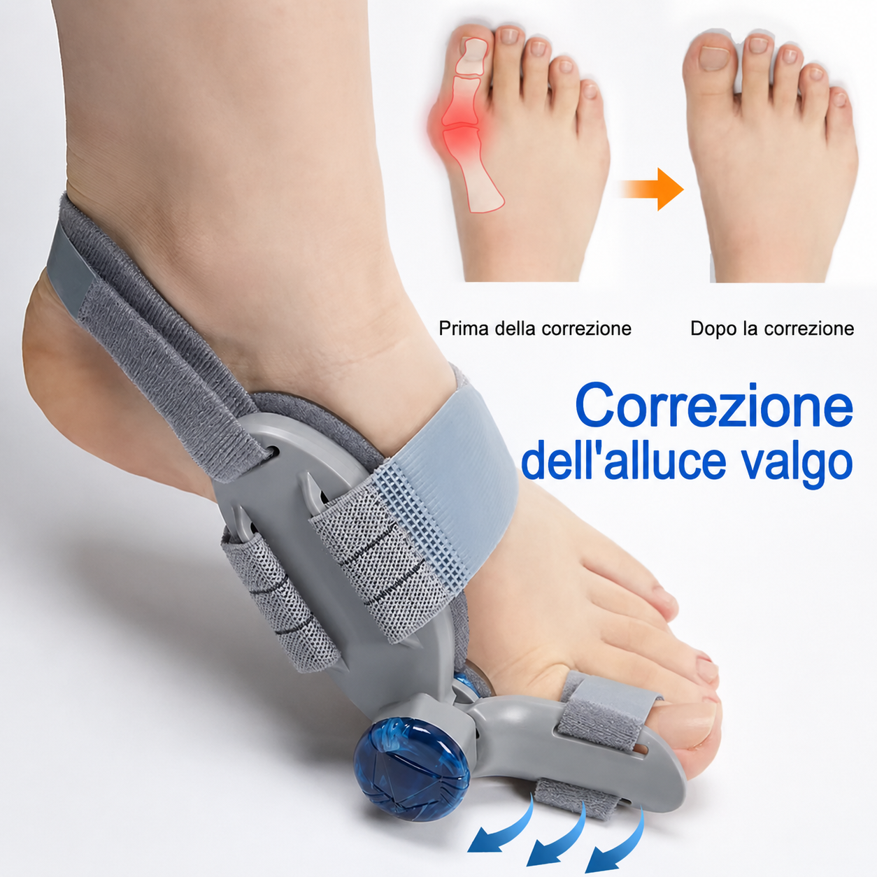 Correttore Alluce Valgo | Meno Dolore ad Ogni Passo