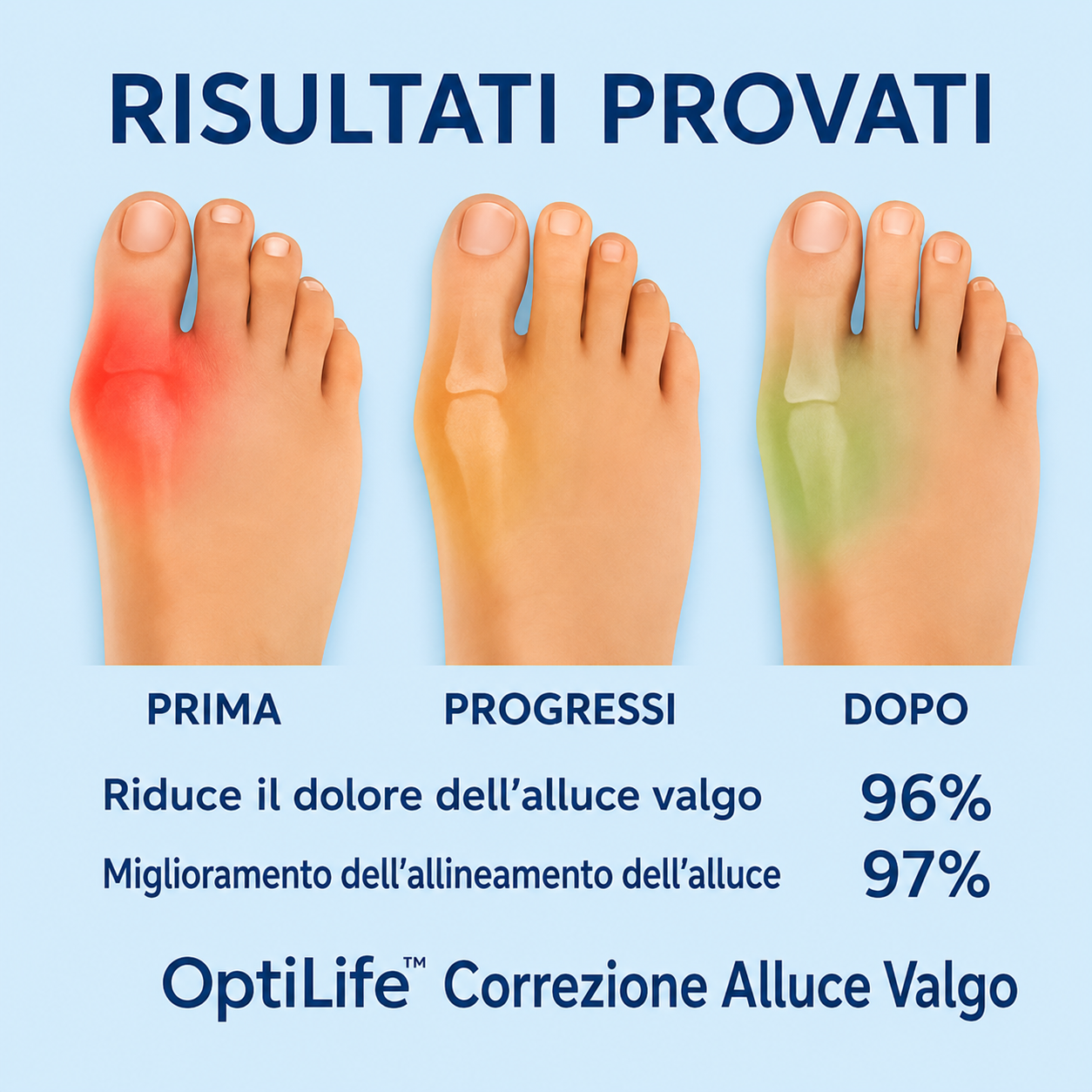 Correttore Alluce Valgo | Meno Dolore ad Ogni Passo